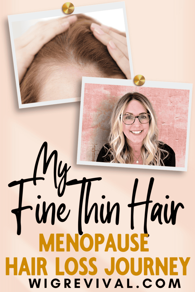 My Fine Thin Hair Dilemma Hair Loss Journey